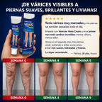 VARICOSE - Crema para Várices, Arañitas, Piernas Cansadas e Hidratación Profunda